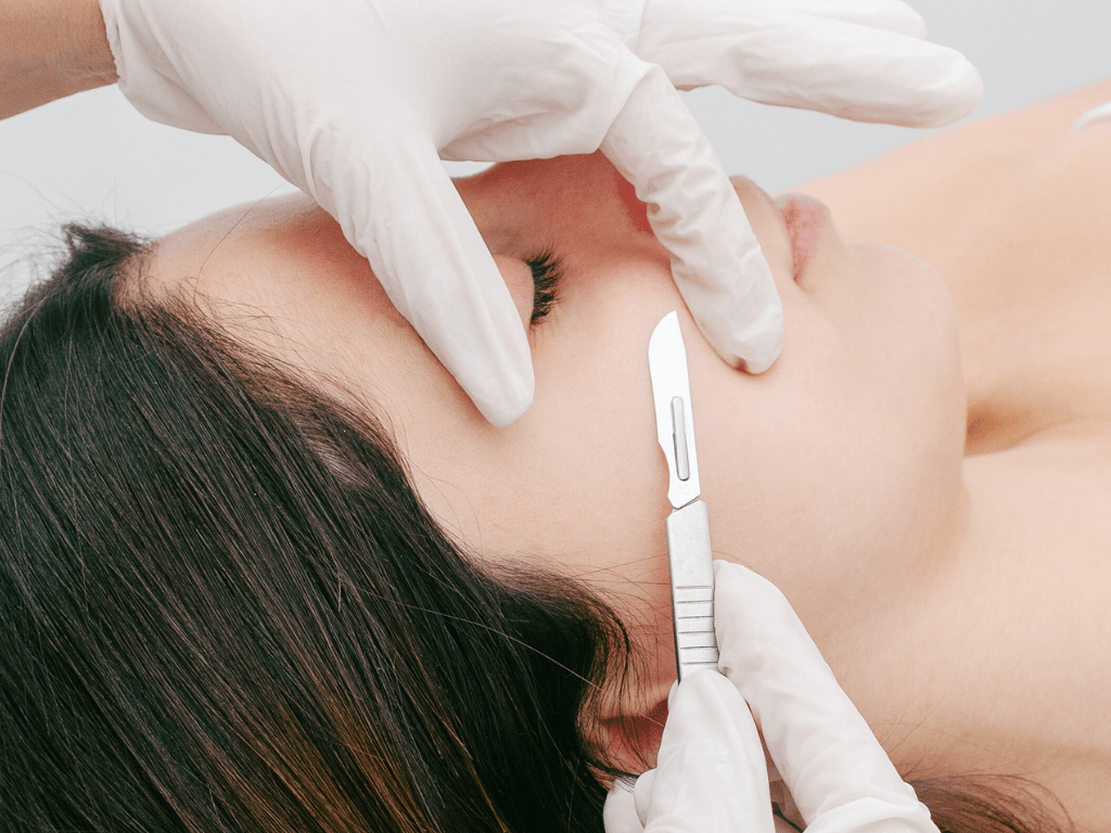 dermaplaning treatment