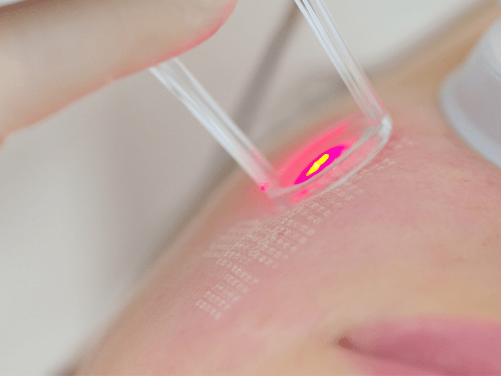 Laser Safety Theory